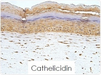 Cathelididin