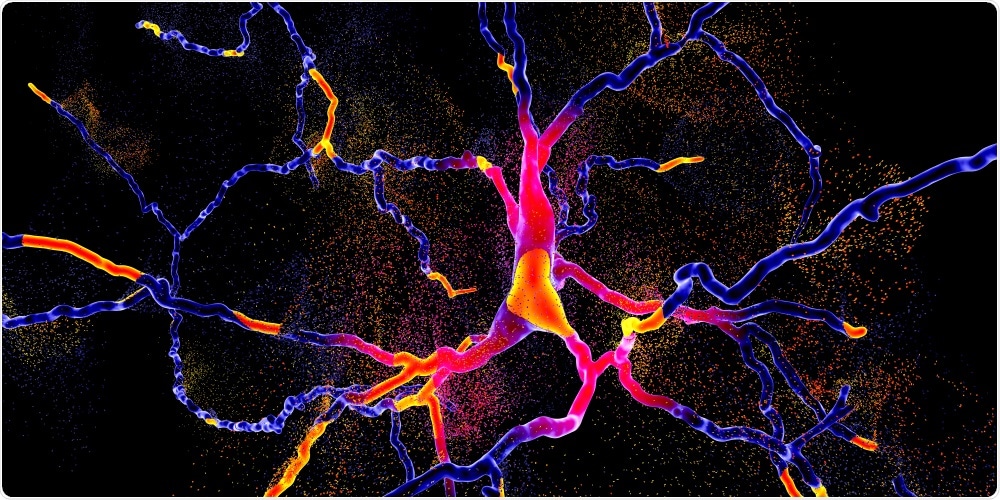Neuronal Network Neuronal Network