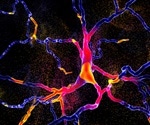 Distinct loss-of-function variants cause shared clinical features in neuronal development disorders