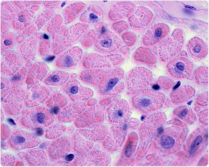 Cardiac Tissue Cardiac Tissue
