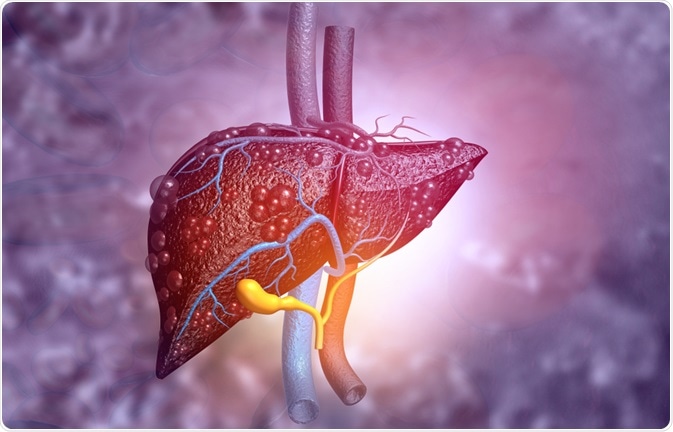 Liver Disease Liver Disease