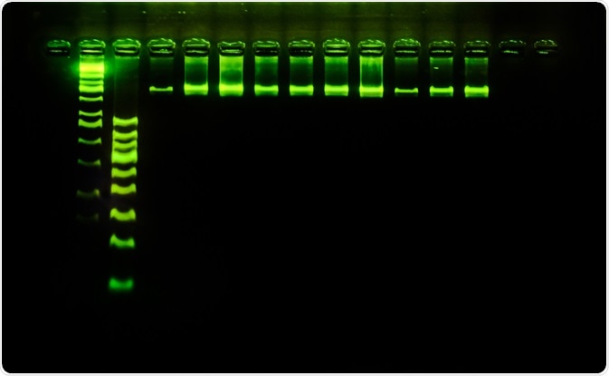 DNA Analysis Electrophoresis DNA Analysis Electrophoresis