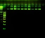 Applications of Capillary Electrophoresis