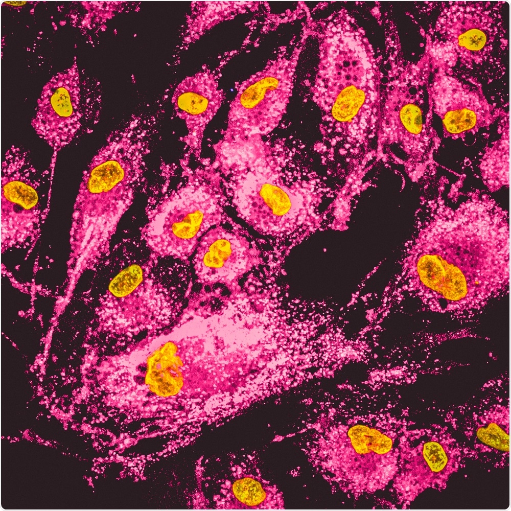 Mammalian Cells Mammalian Cells