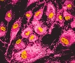 New correlative, 3D, super resolution imaging platform reveals unexpected findings in mammalian cells