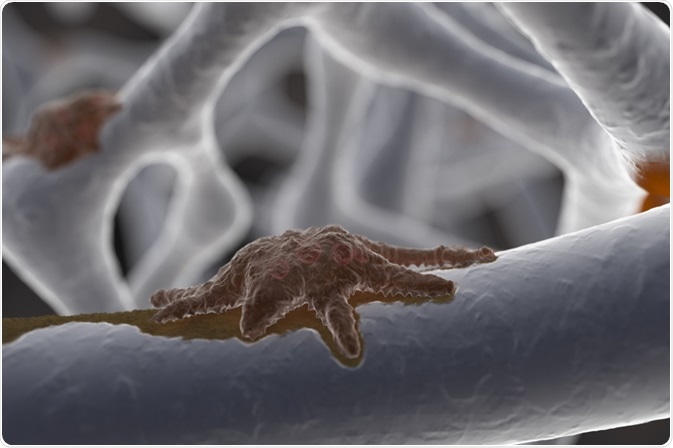 Osteoclast Osteoclast