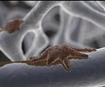 Applications of Osteoclasts in Bone Repair