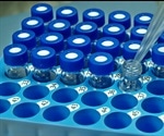 Analyzing Proteomes Using LC-MS/MS