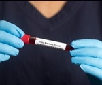 Comparison Between Metabolic Target Analysis and Metabolic Profiling