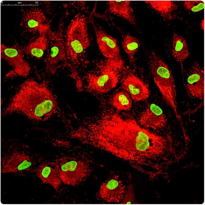Mesenchymal Stem Cells Mesenchymal Stem Cells