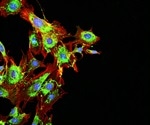Considering evolution of the cancer genome in metastatic disease