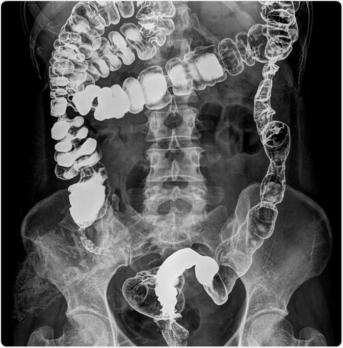 Human GI Tract Human GI Tract