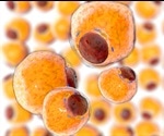 Lipidomics of human adipose tissue reveals diversity between body areas