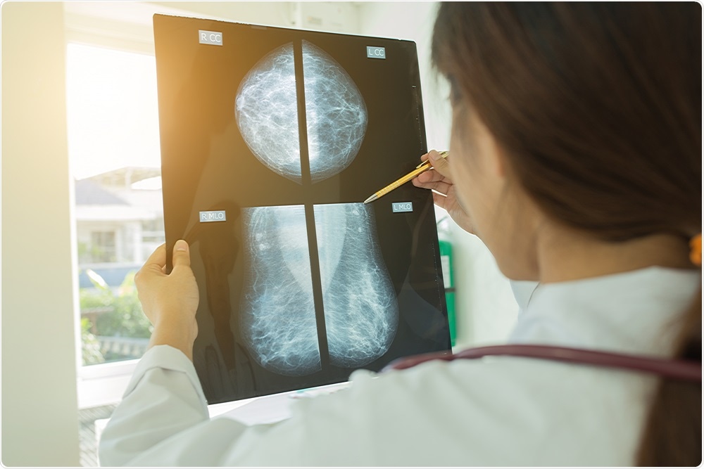 Mammography Mammography