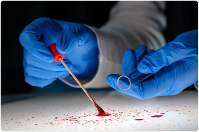 Blood Stain Blood Stain