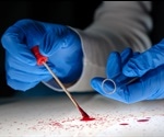 Raman Scattering Applications in Forensic Science