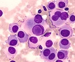 WDR74 modulates melanoma tumorigenesis and metastasis through the RPL5–MDM2–p53 pathway