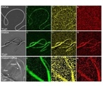 Study demonstrates ability of blended electrospun mat to gradually release protein