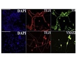 Researchers engineer skin cells into brain cells for effective regenerative therapies