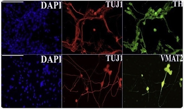 Researchers engineer skin cells into brain cells for effective regenerative therapies