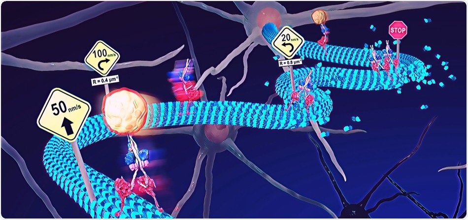 Study tests the effect of deformation of microtubules in neurological conditions