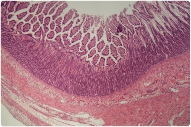 Multi-tissue model shows how different tissues account for various inflammatory diseases