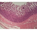 Multi-tissue model shows how different tissues account for various inflammatory diseases
