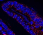 Role of MCL1 in maintaining intestinal homeostasis