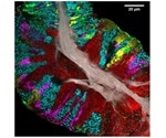 Study develops high-resolution maps of microbial communities on the human tongue