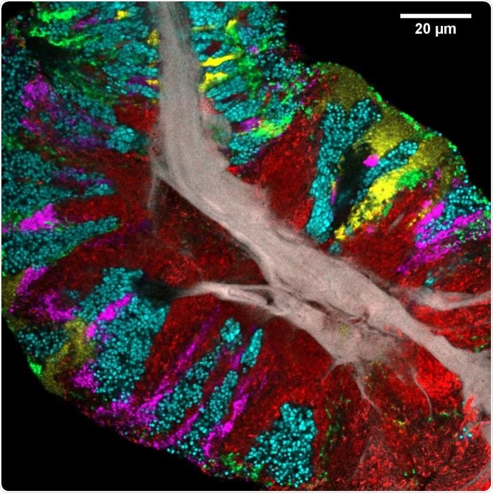 Study develops high-resolution maps of microbial communities on the human tongue