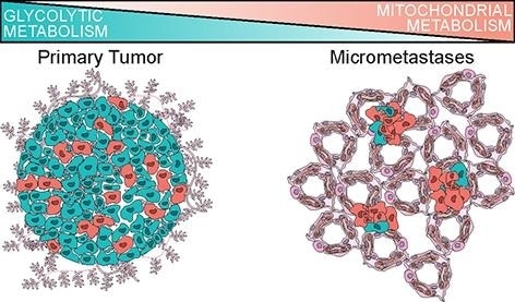 A new breakthrough could lead to better approaches for preventing breast cancer metastasis