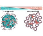 A new breakthrough could lead to better approaches for preventing breast cancer metastasis