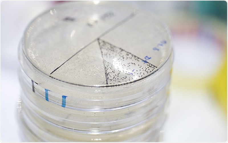 Researchers capture occurrence of bursts of diversity in microbiota in real time