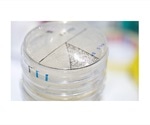 Researchers capture occurrence of bursts of diversity in microbiota in real time