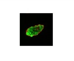 Study finds fatty acid uptake is greater in cells that lack EHD2 protein