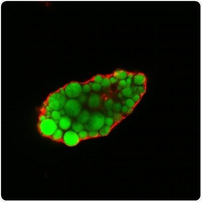 Study finds fatty acid uptake is greater in cells that lack EHD2 protein Study finds fatty acid uptake is greater in cells that lack EHD2 protein
