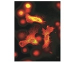 Researchers uncover a surprising property of blood stem cells