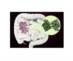 Study discovers structure of bacterial enzyme that breaks down amino acid found in collagen