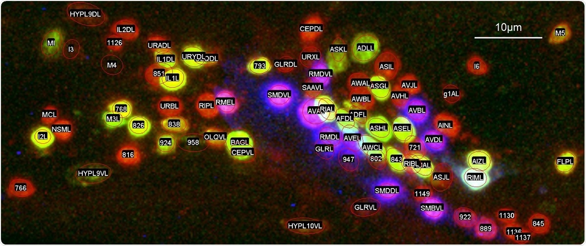 New computer program can help map individual nerve cells in worms New computer program can help map individual nerve cells in worms