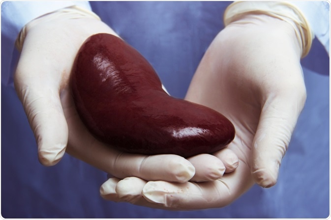 Kidney Transplant Kidney Transplant