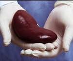 Why Kidney Transfers are Now Allowed from Donors with Hepatitis C Infection