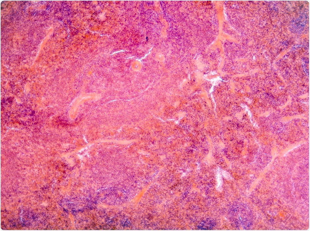 Pancreas Tissue Pancreas Tissue