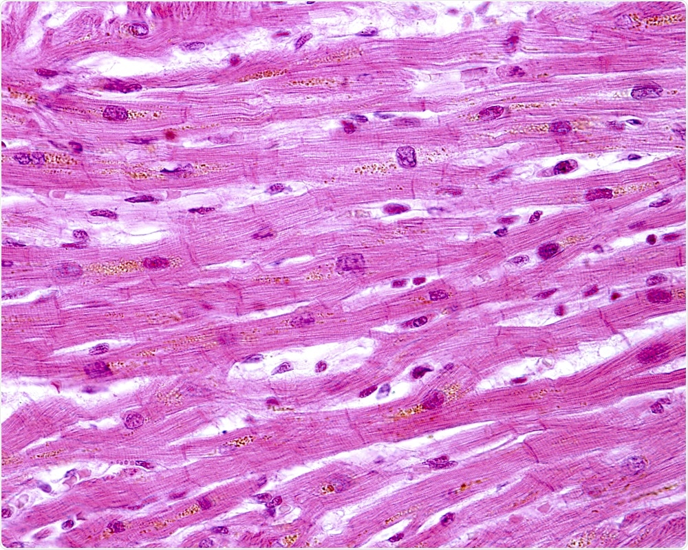 Muscle Cells Muscle Cells