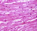 New technology used to probe and catalog activity of cells involved in muscle repair
