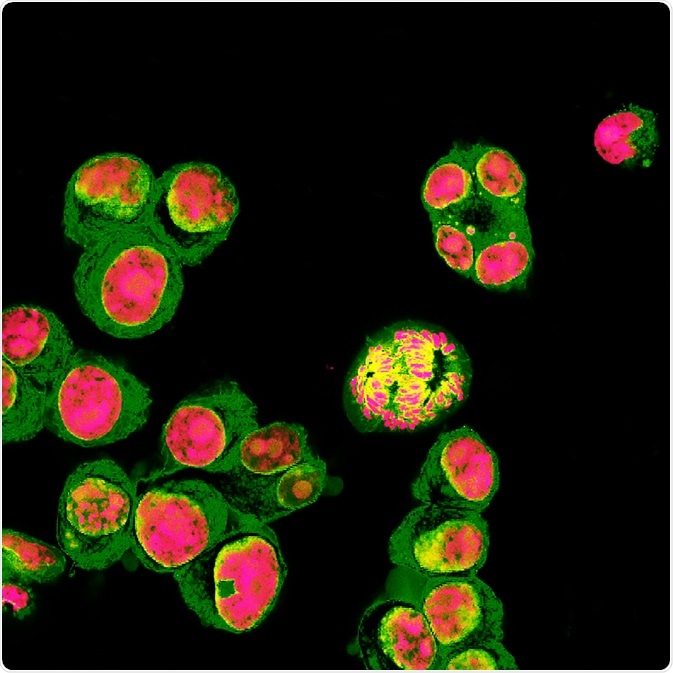 Fluorescence Microscopy Fluorescence Microscopy