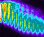 Study examines molecular causes of spondylocostal dysostosis