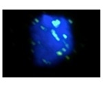 NMR spectroscopy reveals mechanisms involved in DNA repair