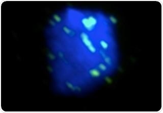 Nuclear magnetic resonance spectroscopy reveals mechanisms involved in DNA repair