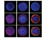Study shows how human embryonic stem cells commit to early specialization