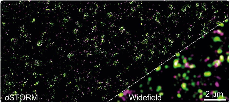 Study sheds light on the synapses of the human nervous system